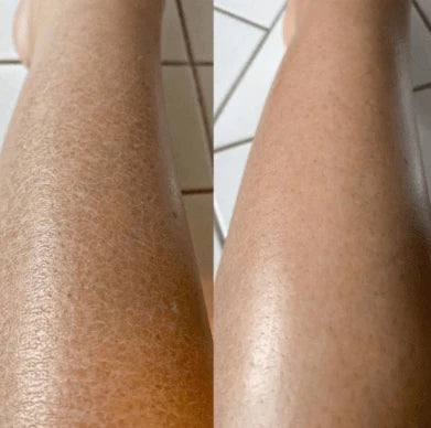 Exfloting Gloves Dead Skin Remover